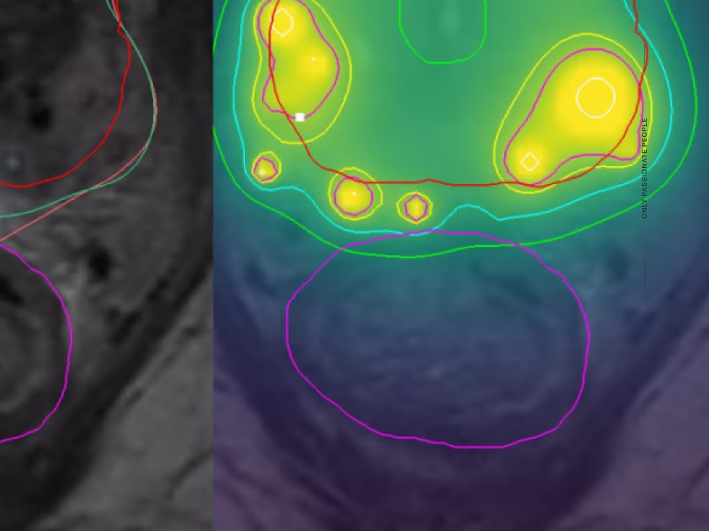 Clinical image slice with contour annotations and model-output overlays