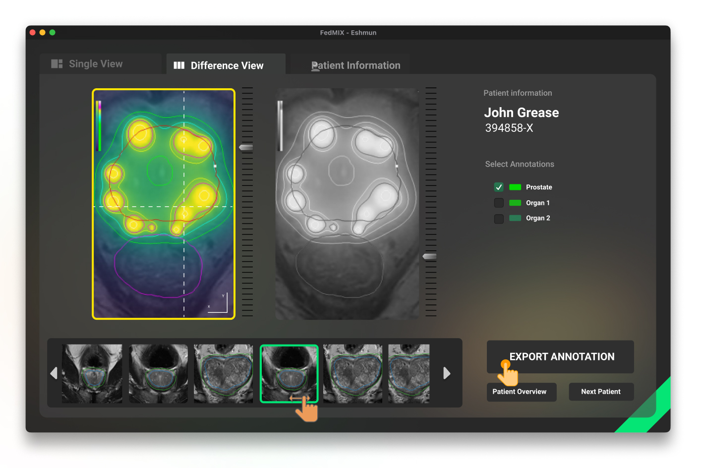 Multi-panel clinical viewer workflow for image comparison and annotation